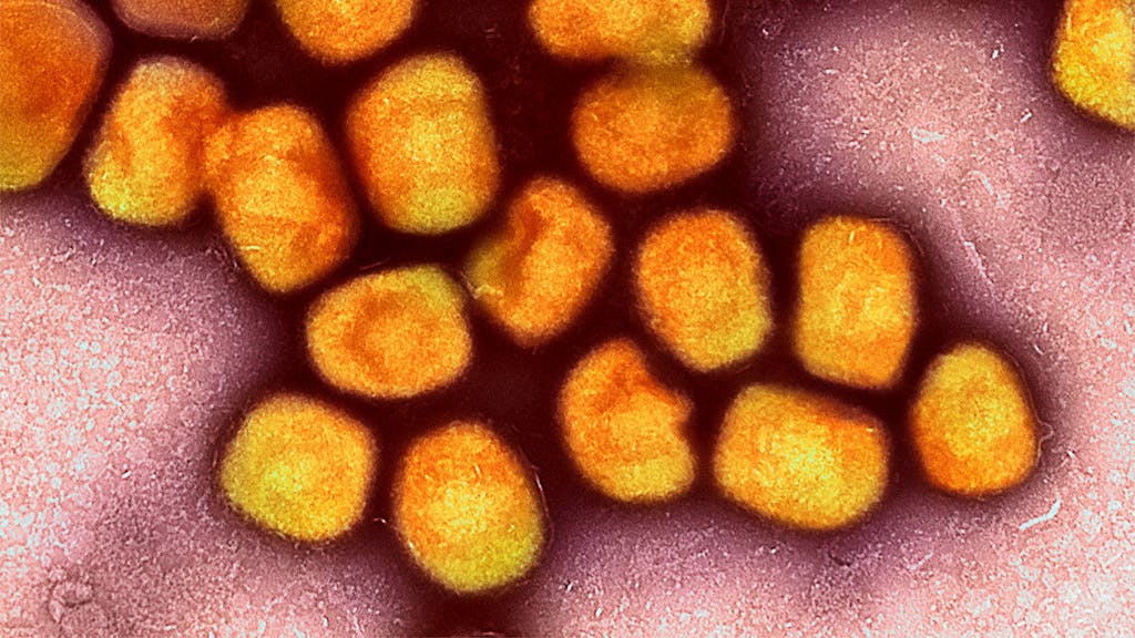 Das Foto zeigt eine kolorierte transmissionselektronenmikroskopische Aufnahme von Partikeln des Affenpockenvirus (Gold).