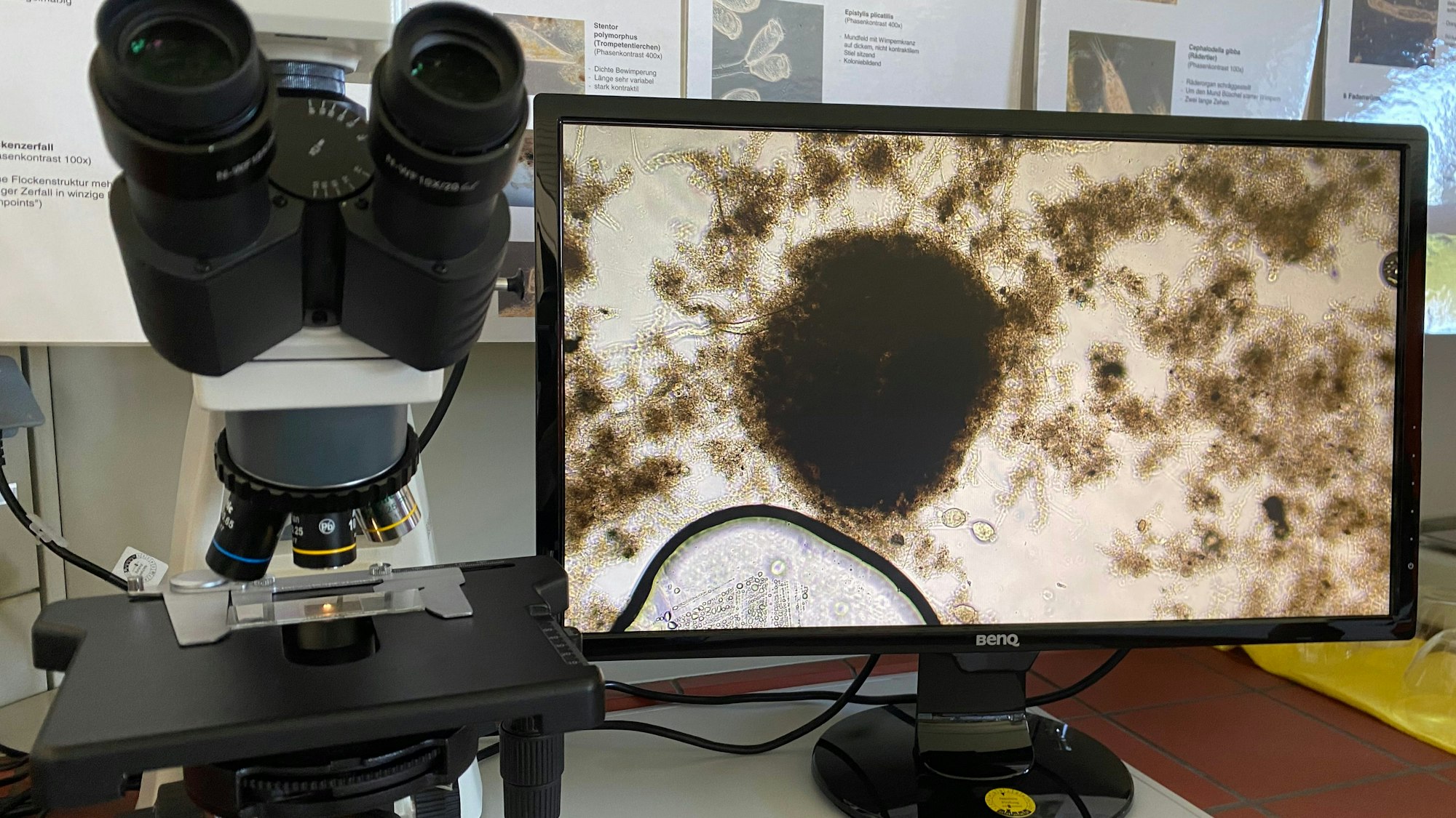 Das Bild zeigt ein Mikroskop. Daneben befindet sich ein Bildschirm, auf dem Mikroorganismen zu sehen sind.
