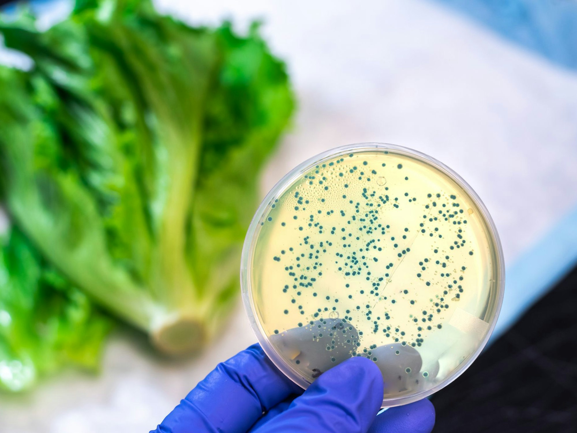 Eine Laborprobe mit E. coli Bakterien.