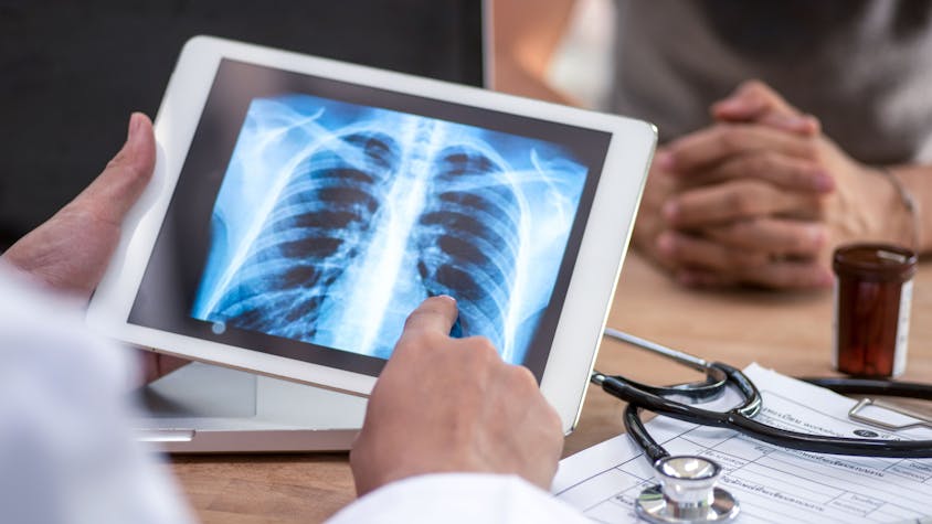 Ein Arzt liest den Lungen-Scan auf einem digitalen Tablet-Bildschirm.