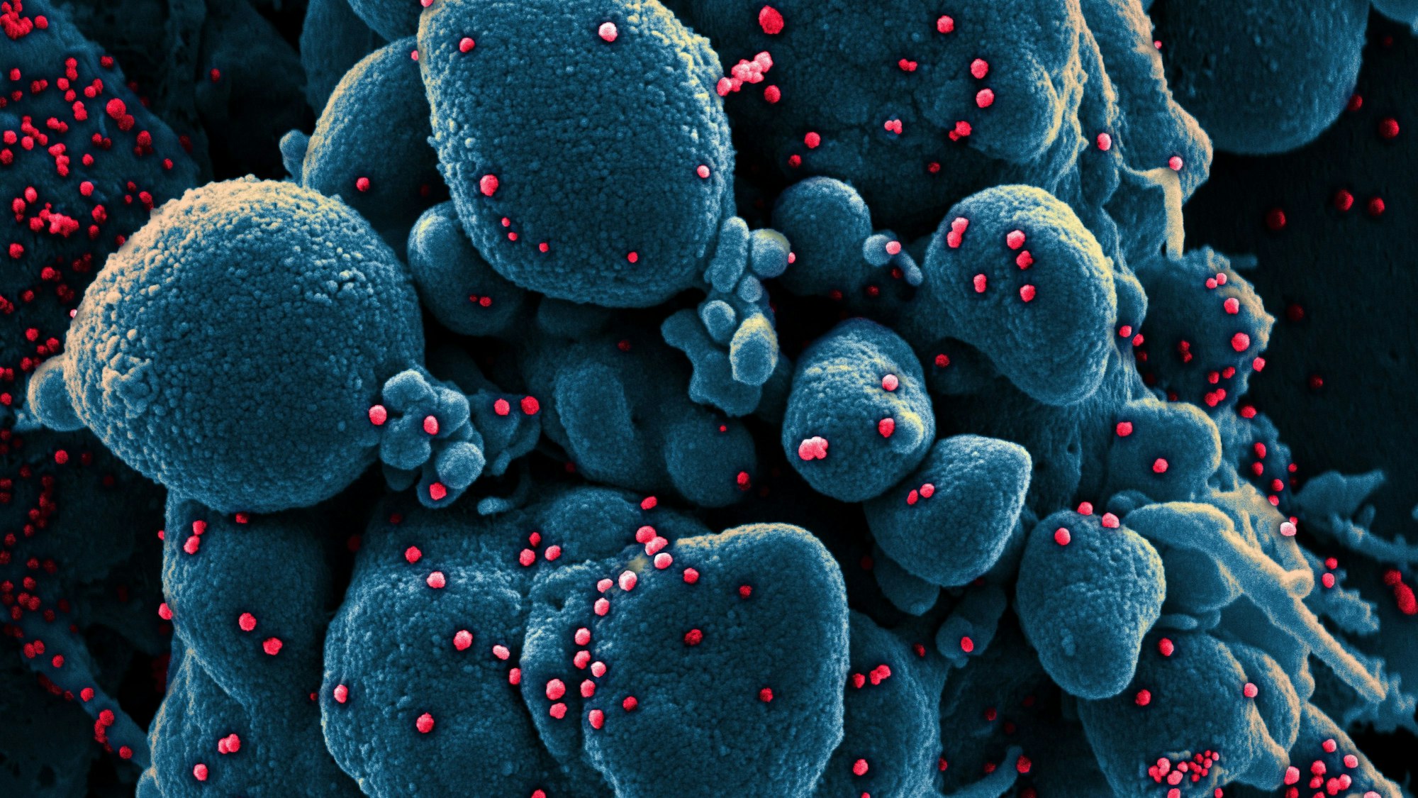 Die Aufnahme zeigt eine Zelle (blau), die mit dem Coronavirus (SARS-CoV-2, rot) infiziert ist. Eine britische Studie deutet nun darauf hin, dass der Wirkstoff Molnupiravir für zusätzliche Mutationen des Virus sorgen könnte. (Archivbild)