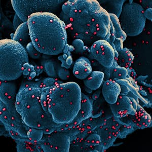 Eine Aufnahme des Coronavirus unter einem Mikroskop, bereitgestellt vom „National Institute of Allergy and Infectious Diseases“ (NIAID).