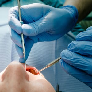 Ein Zahnarzt behandelt eine Patientin. (Archivbild/Symbolbild)
