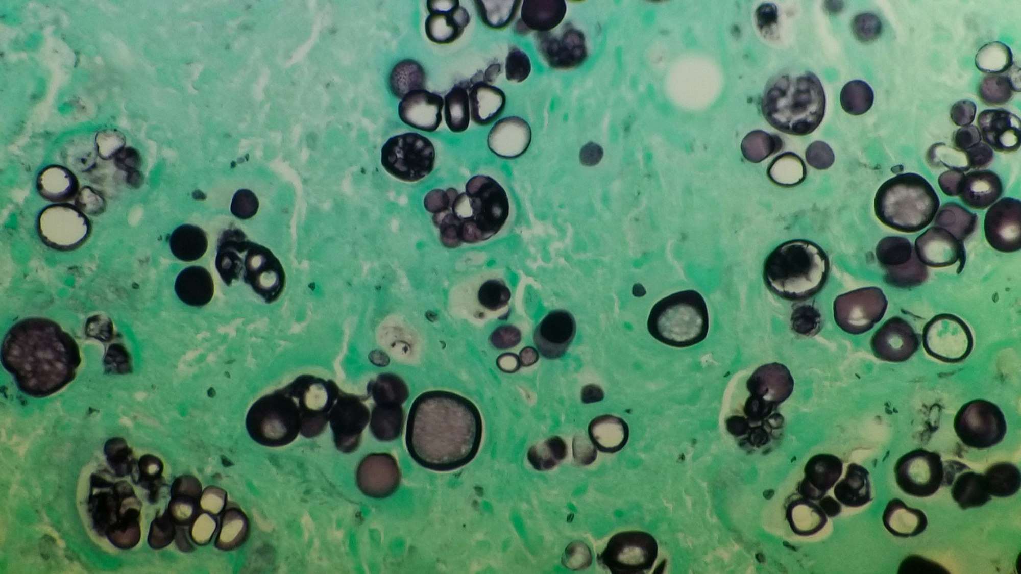 Coccidioides imitis unter dem Mikroskop. Der Pilz breitet sich in den USA immer mehr aus. Grund dafür ist laut Forschern der Klimawandel. (Archivbild)