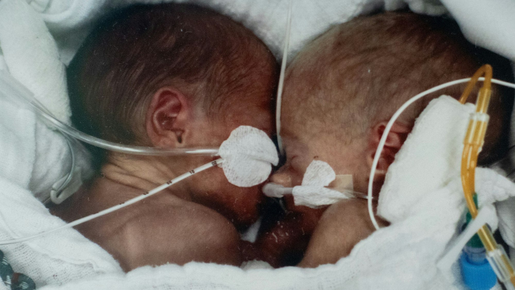 Die Zwillings-Frühchen Lia Sophie und Emilia kurz nach der Geburt