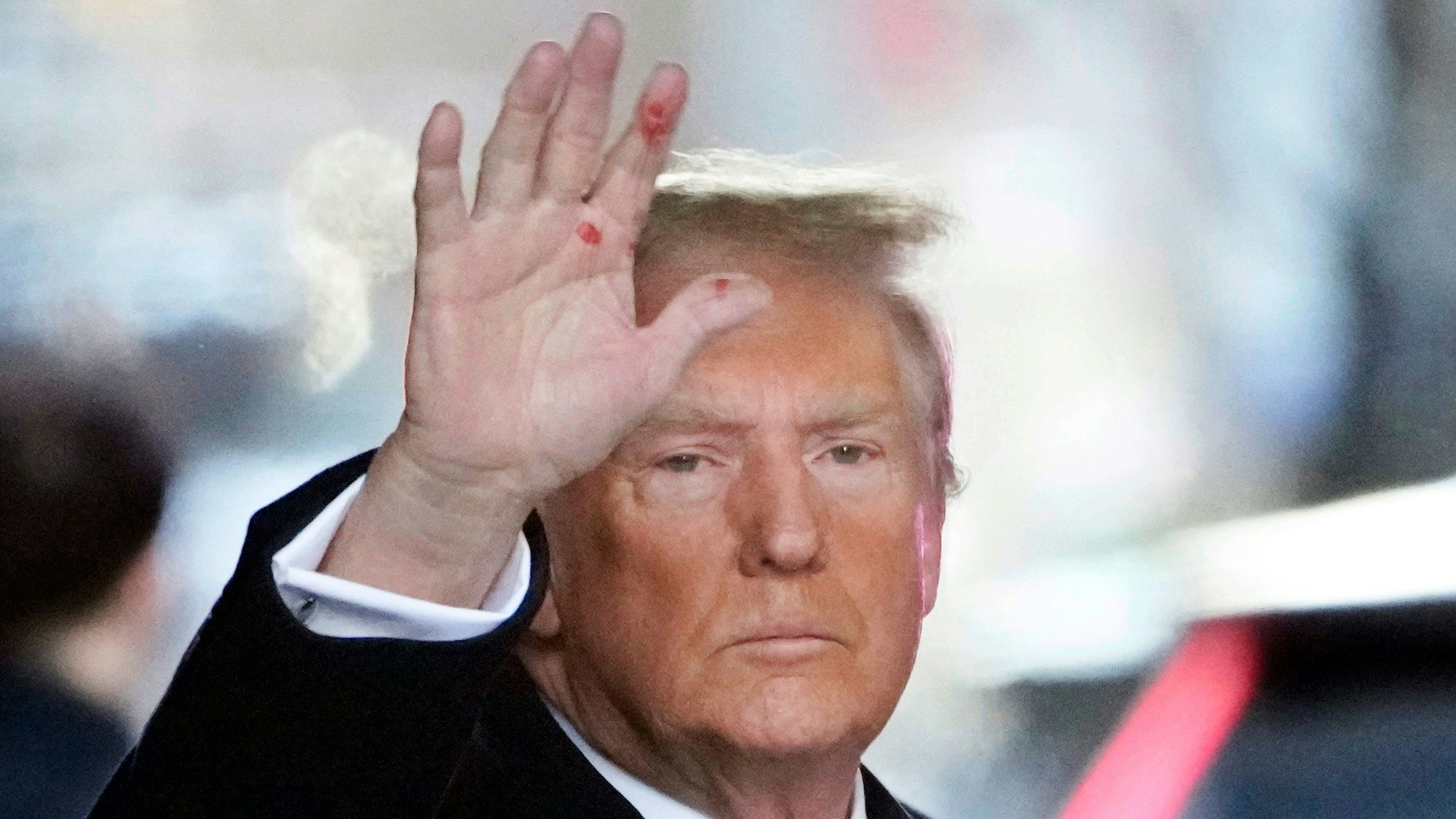 Donald Trump, Präsidentschaftskandidat der Republikaner, hat sichtbar rote Flecken an der Hand. Woher diese stammten, verrieten nun Vertraute des ehemaligen US-Präsidenten.