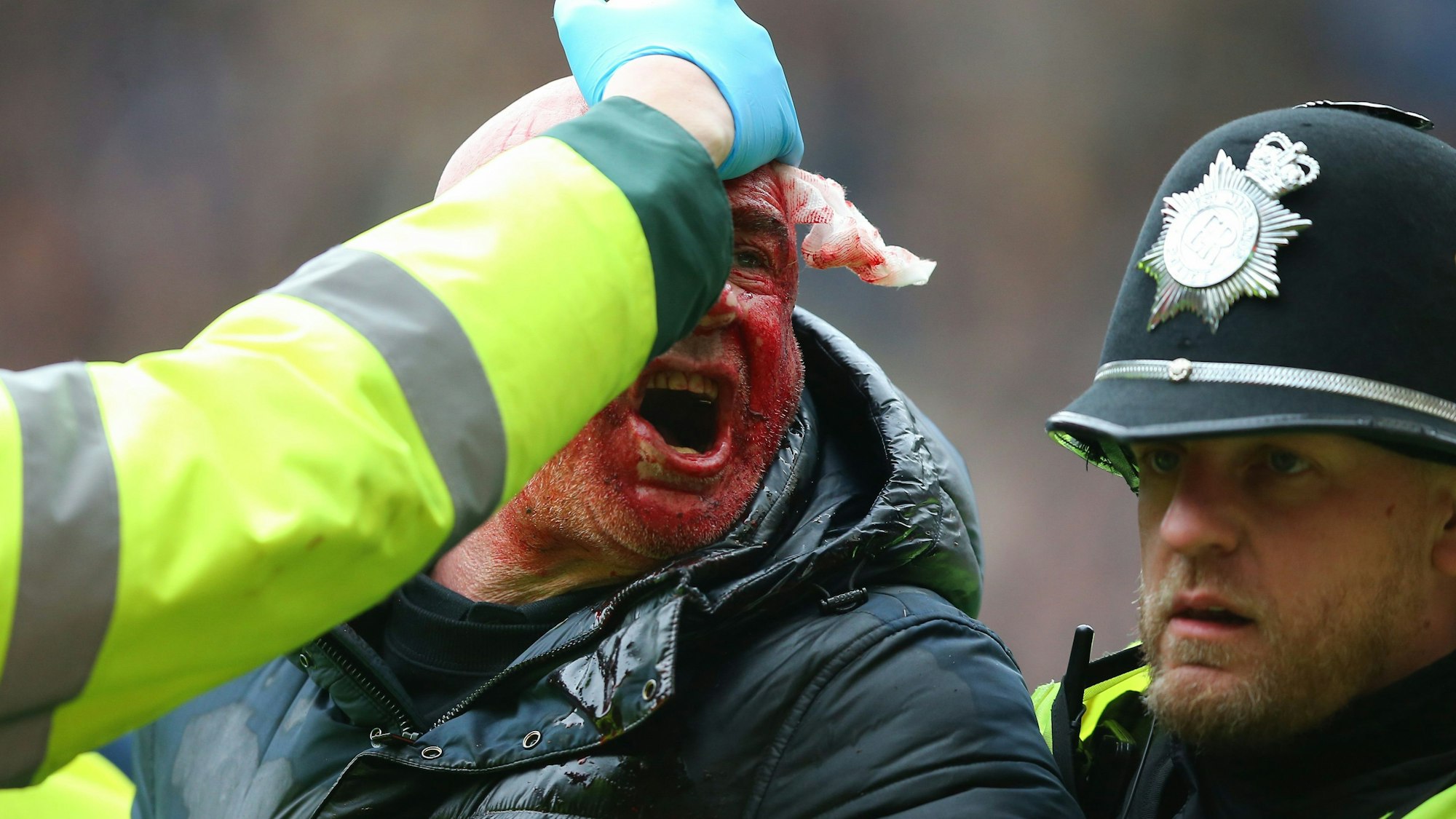 Während des Spiels wird ein Fan von der Polizei aus dem Stadion gebracht, während er wegen einer Kopfwunde behandelt wird.