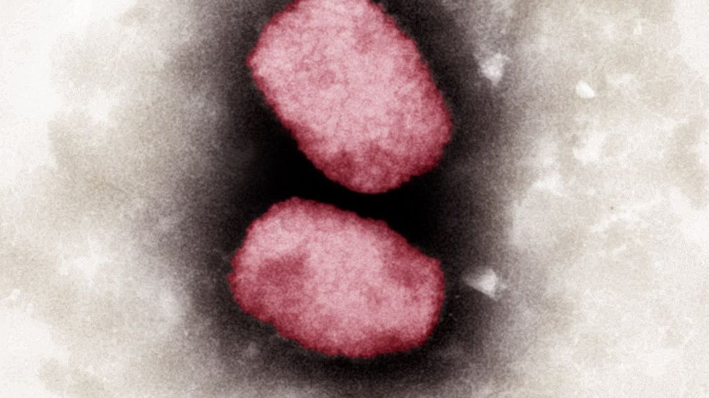 Elektronenmikroskopische Aufnahme von Affenpocken-Viren (2001): Das Alaskapocken-Virus gehört - wie auch das Affenpockenvirus - zu den Orthopoxviren.