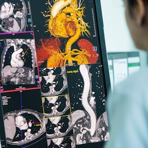 Ein Mitarbeiter sitzt vor einem Monitor, der eine Darstellung der Aorta aus dem Computertomographen (CT) zeigt.