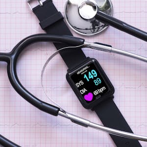 Mit einer Smartwatch kann der Blutdruck gemessen werden.