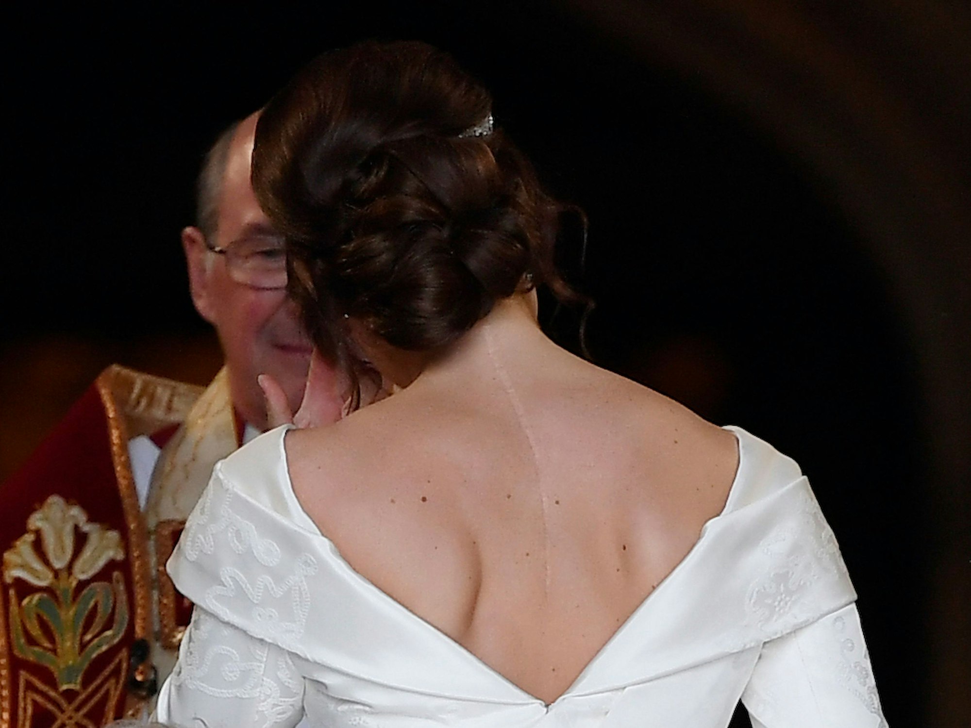 Für ihr Hochzeitskleid wählte Prinzessin Eugenie bewusst einen tiefen Rückenausschnitt. So wurde eine Narbe von einer Skoliose-Operation im Alter von zwölf Jahren sichtbar.