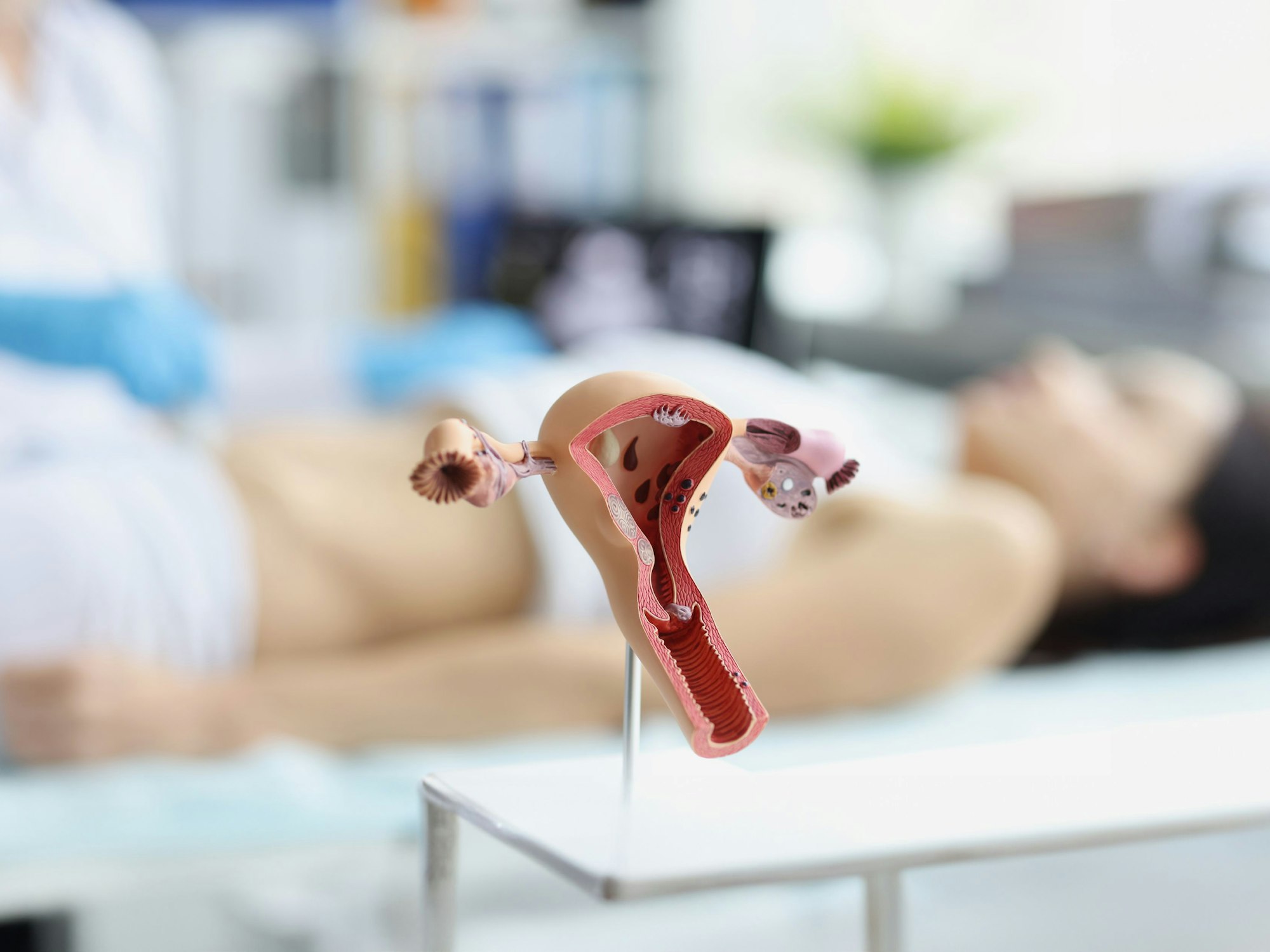 Anatomisches Modell eines Uterus.