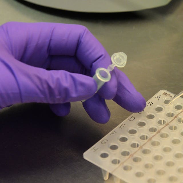 In einem Labor werden Blutproben auf das Virus H5N1, auch bekannt als Vogelgrippe, getestet. Im US-Bundestaat Texas hat sich ein Mann mit der Krankheit infiziert.