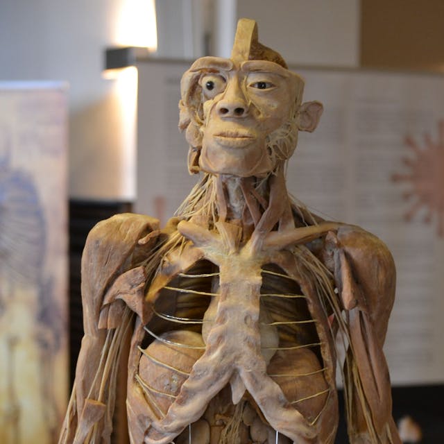 Das Bild zeigt einen präparierten menschlichen Körper.