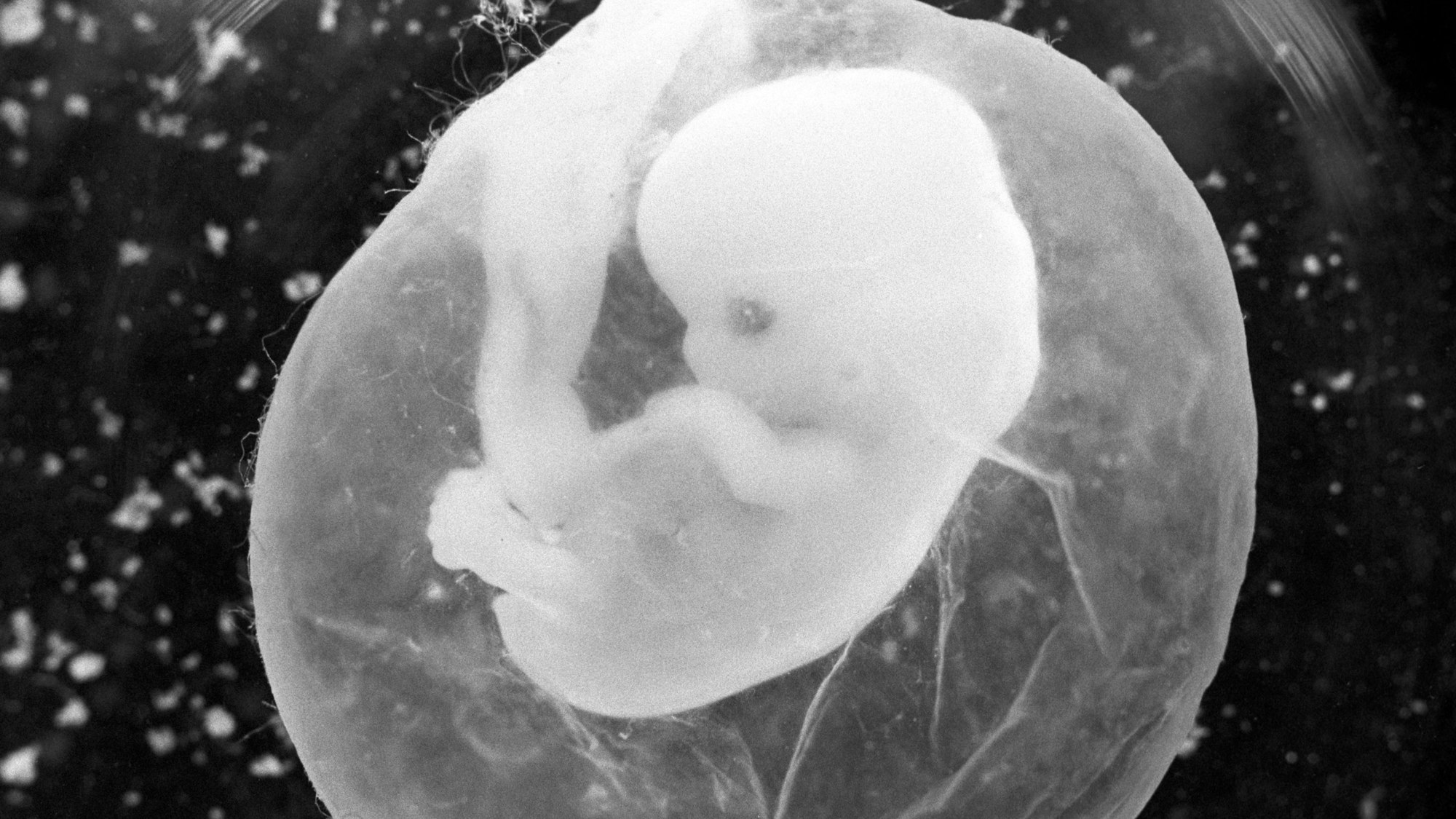 Sieben Wochen alt ist dieser Embryo in seiner Fruchtblase, von der achten Woche an sprechen Mediziner von einem Fötus.