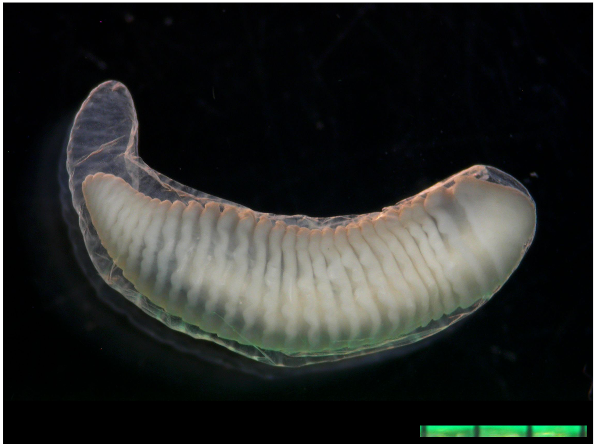 Dieser Parasit wurde aus dem Auge einer Elfjährigen entfernt. Es handelt sich um „Armillifer grandis“ – eine Zungenwurmart.