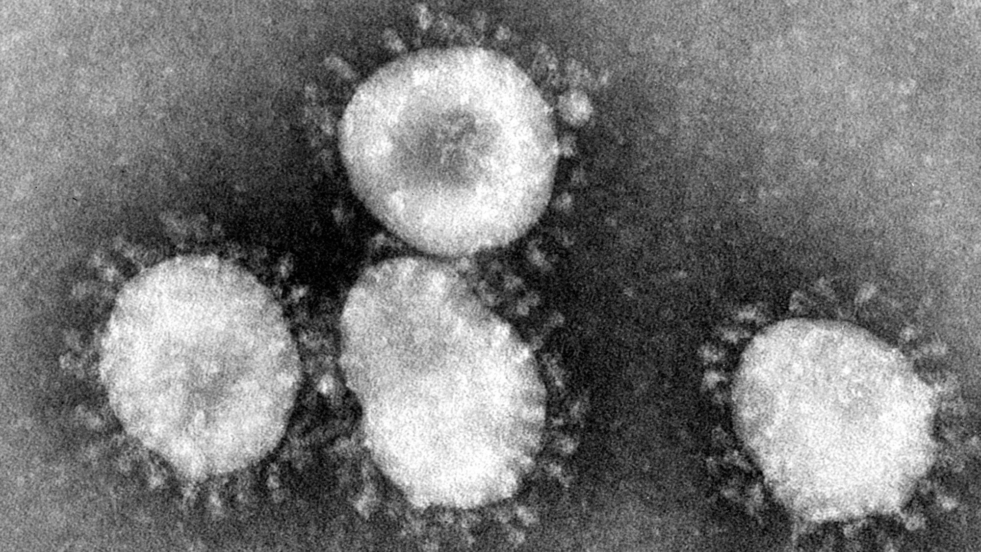 Coronavirus unter dem Mikroskop. 