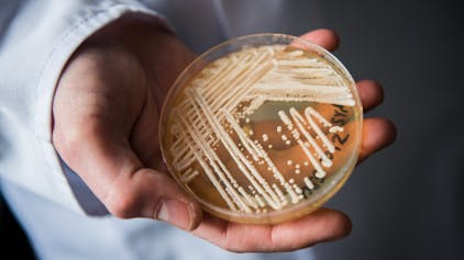 Der Leiter des Nationalen Referenzzentrums für invasive Pilzinfektionen, Oliver Kurzai, hält in einem Labor der Universität in Würzburg (Bayern) eine Petrischale mit dem Hefepilz Candida auris in den Händen.