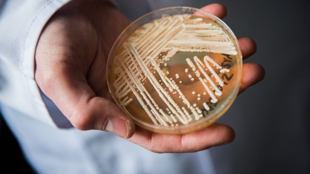 Der Leiter des Nationalen Referenzzentrums für invasive Pilzinfektionen, Oliver Kurzai, hält in einem Labor der Universität in Würzburg (Bayern) eine Petrischale mit dem Hefepilz Candida auris in den Händen.