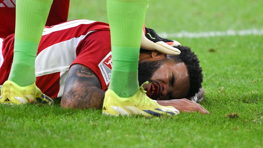Fortuna Düsseldorfs Jamil Siebert liegt im Spiel gegen den 1. FC Nürnberg mit blutendem Mund auf dem Boden.