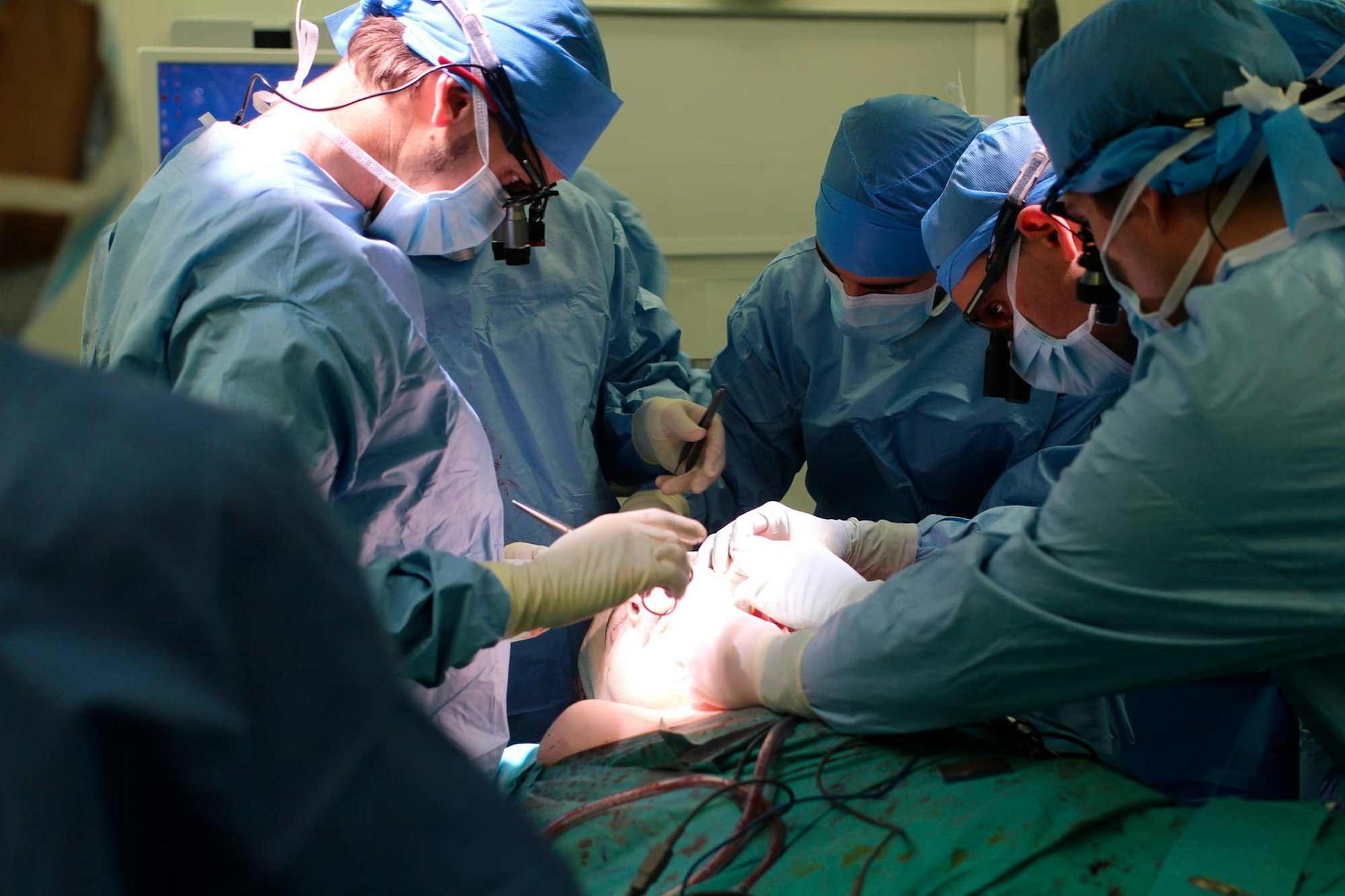 Gesichtstransplantation Jerome Hamon Operation