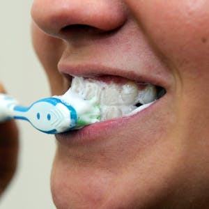 Wer sich zu oft die Zähne putzt, könnte seinem Zahnschmelz schädigen.