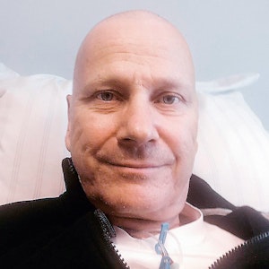 Westerwelle, gezeichnet von der Chemo-Therapie.