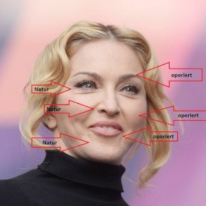 Aufspritzen, glatt bügeln oder direkt unters Messer: Madonna lässt ihr Gesicht regelmäßig vom Arzt bearbeiten. Nur die Falten um Augen, Nase und am Kinn lässt sie so.