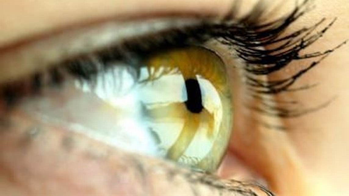 Kontaktlinsen oder Klimaanlagen sorgen häufig für trockene Augen.