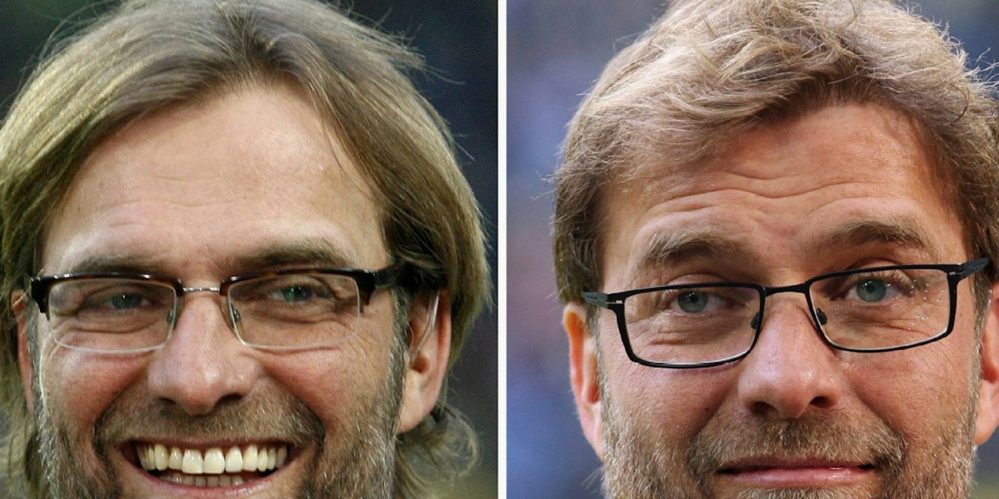 Borussia-Dortmund-Trainer Jürgen Klopp im April 2012 und nach einer Haartransplantation im März 2013.