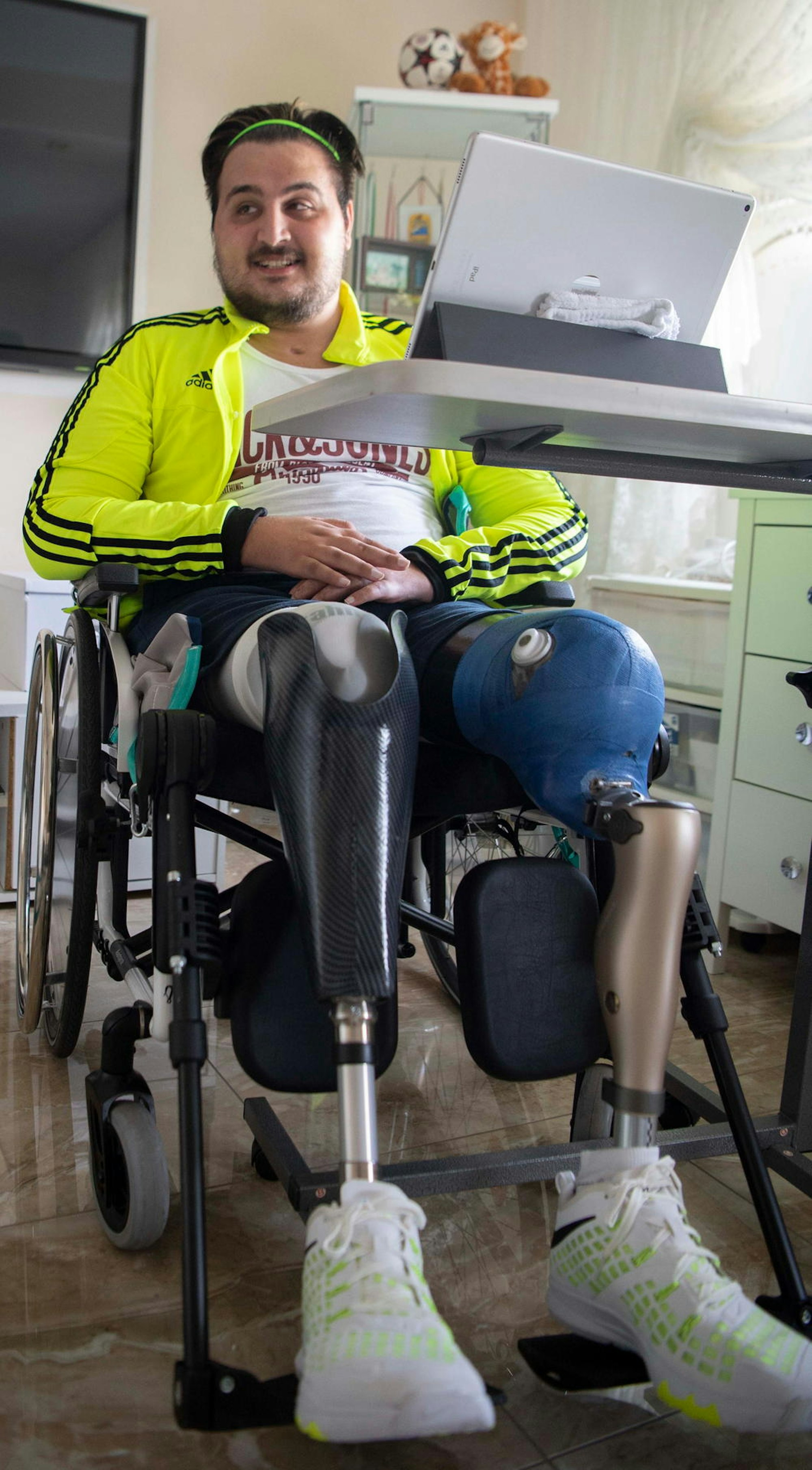Durch eine Blutvergiftung wäre Ibrahim Khaled fast ums Leben gekommen. Er verlor beide Beine, nicht aber seinen Lebensmut und seinen Kampfgeist. Nächstes Jahr will er wieder laufen können.