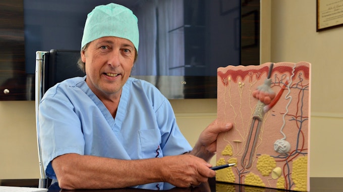 Dr. Villnow zeigt in seiner Praxis anhand eines Modells, wo die Haare zur Transplantation entnommen werden.