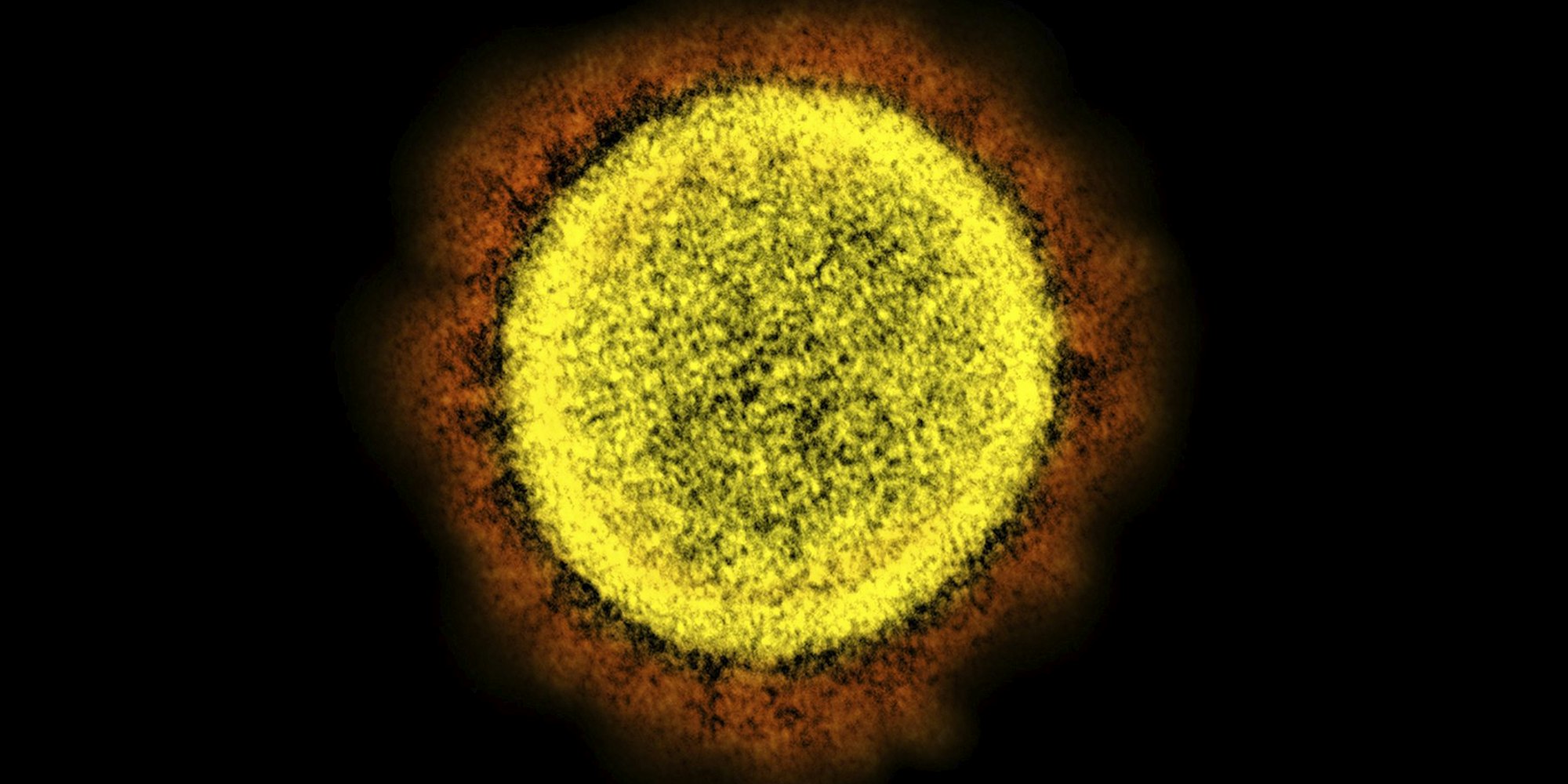 Coronavirus_Partikel