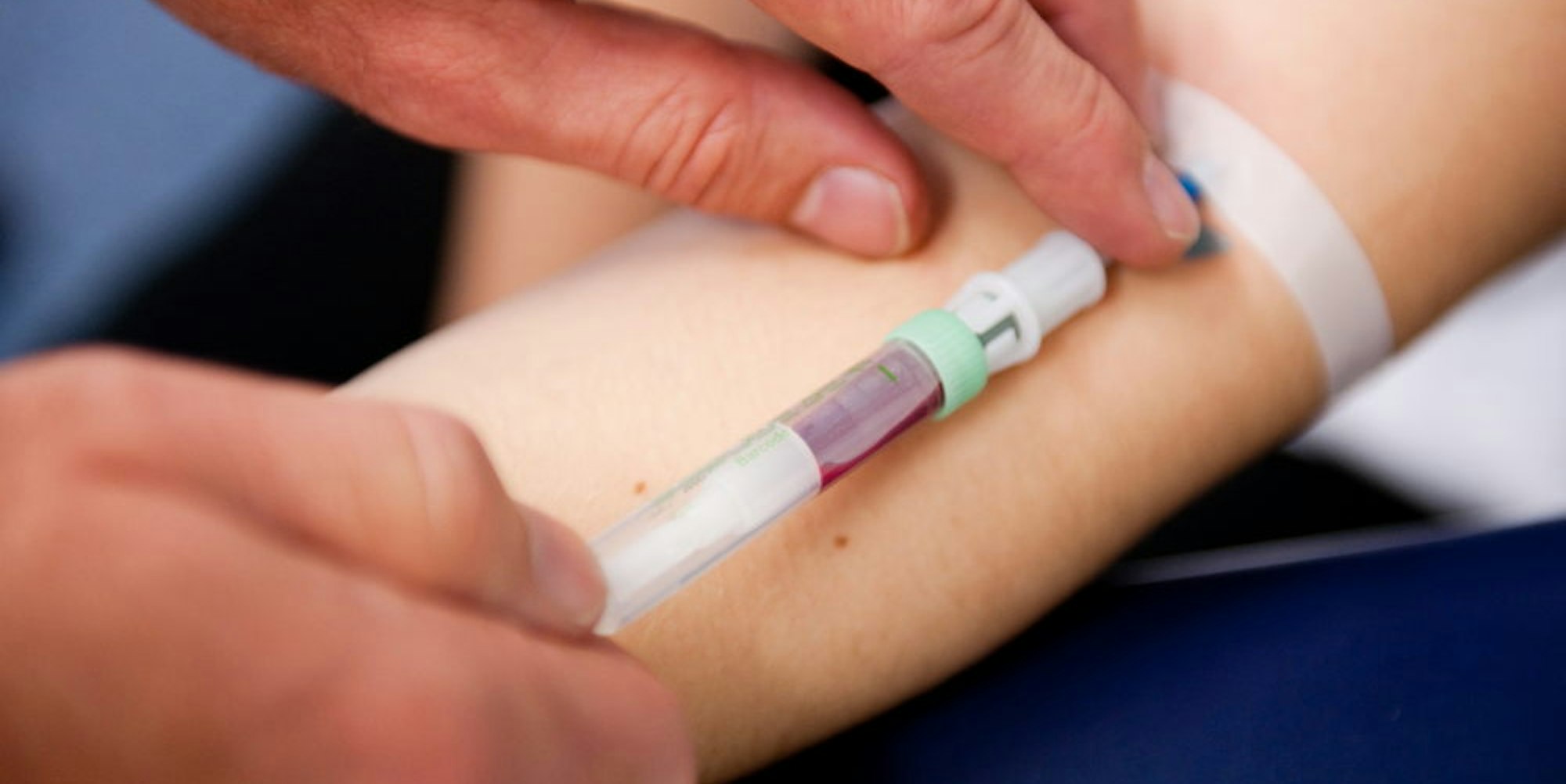 Mehr als 500 Mechernicher haben im vergangenen Jahr ihr Blut auf Bleigehalt testen lassen.