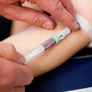Mehr als 500 Mechernicher haben im vergangenen Jahr ihr Blut auf Bleigehalt testen lassen.