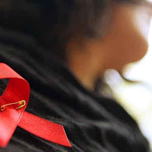 Eine Frau hat sich eine rote Aids-Schleife angesteckt