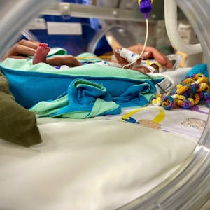 Im Klinikum Leverkusen wurden in vergangenen Jahr 345 frühgeborene Kinder behandelt.