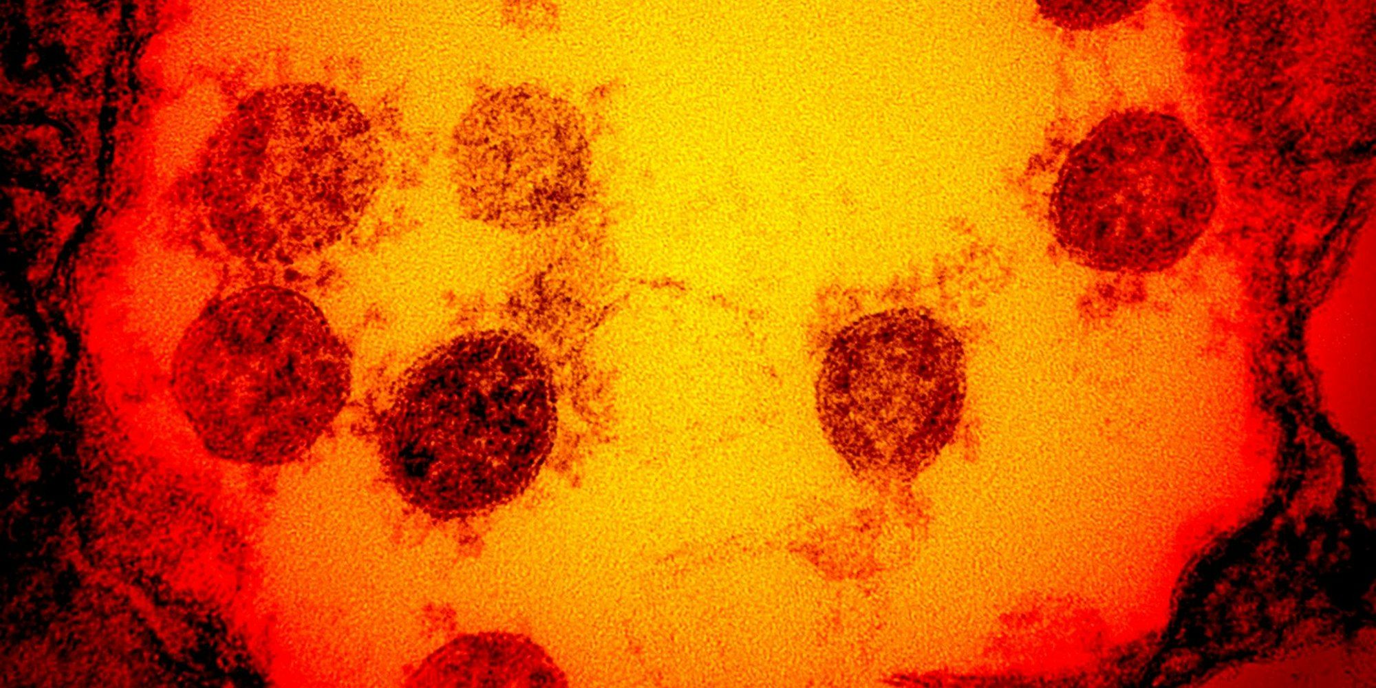 SARS-COV-2 Virus Mikroskop