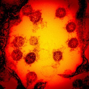 SARS-COV-2 Virus Mikroskop