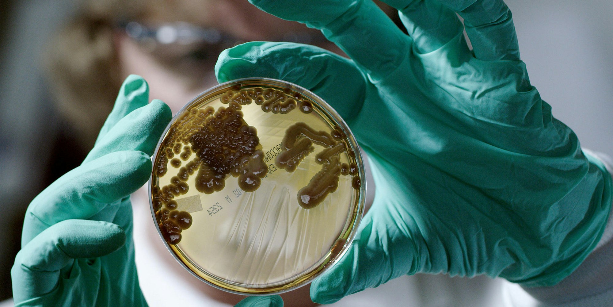 Kulturen von Mikroorganismen in einer Petrischale (c) BROADVIEW PICTURES Foto ZDF