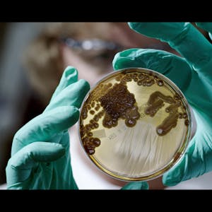 Kulturen von Mikroorganismen in einer Petrischale (c) BROADVIEW PICTURES Foto ZDF