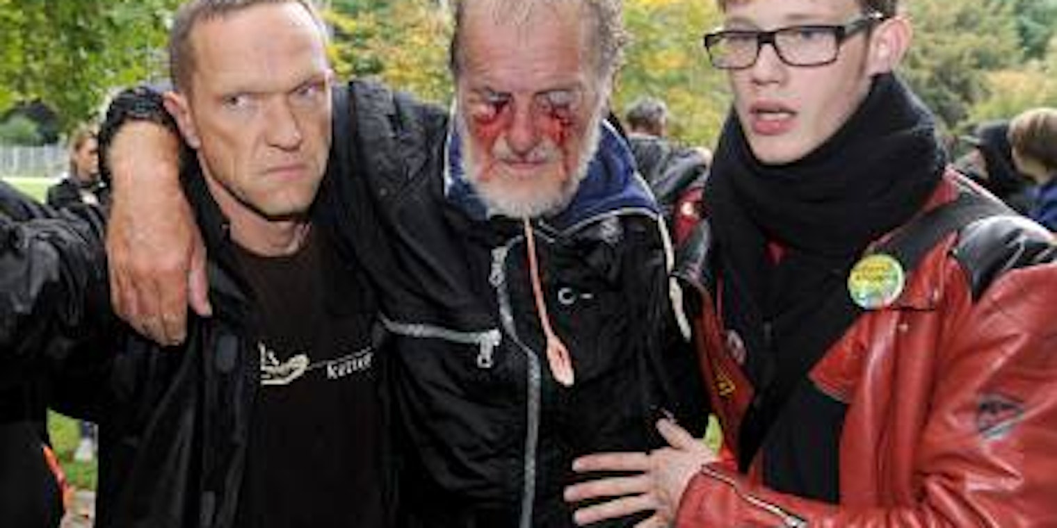 Dietrich Wagner, der Demonstrant aus dem Stuttgarter Schlossgarten mit den blutigen Augenverletzungen. (Bild: dpa)