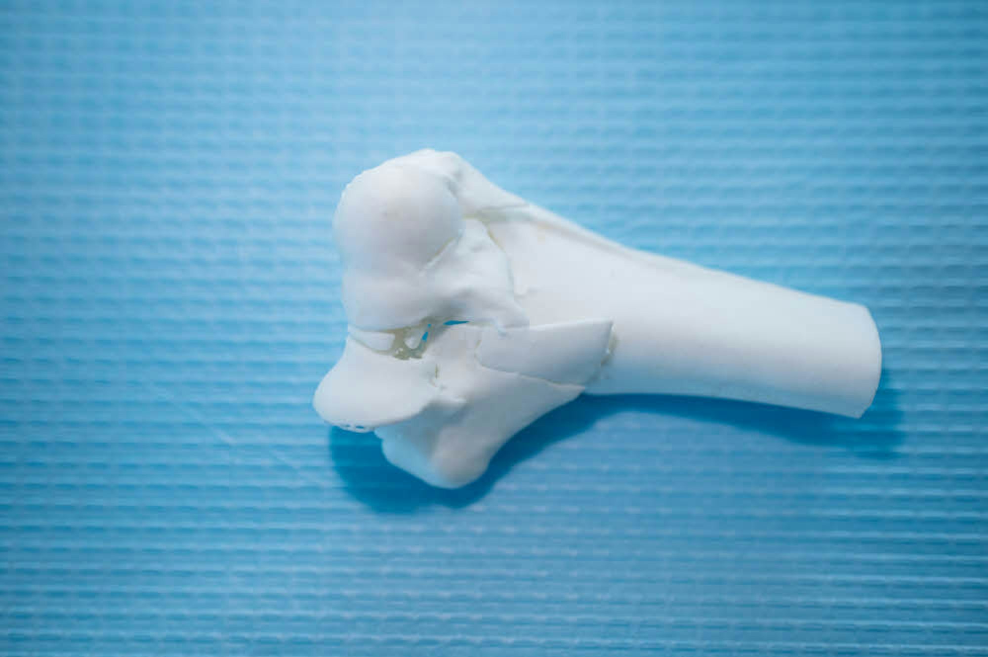 Dieses Knochen-Modell stammt aus einem 3D-Drucker.