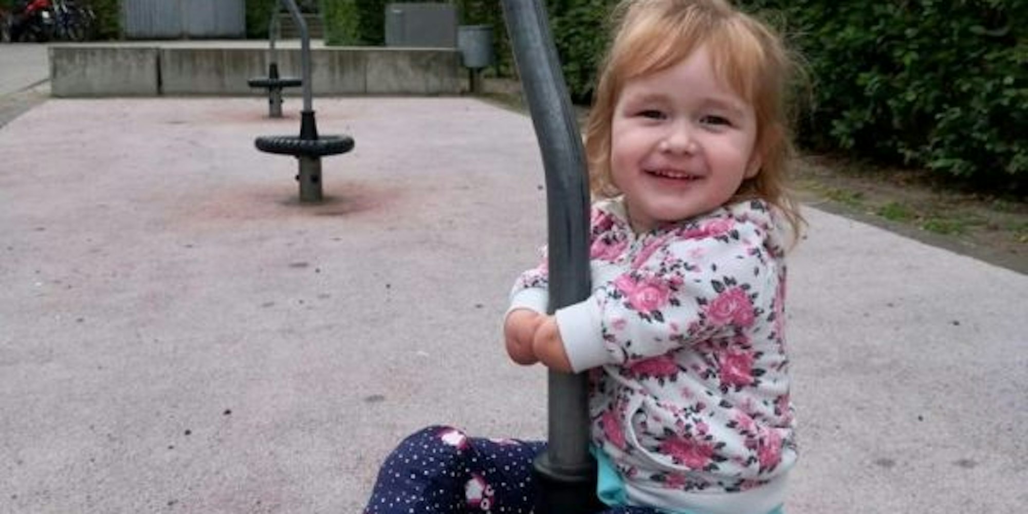 Die dreijährige Milana: Auf dem Spielplatz trägt sie ihre Beinprothesen.