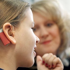 Ein Mädchen mit Cochlea-Implantaten: Der Sprachprozessor sowie die Sendespule, die außen am Kopf getragen werden, bleiben nach der OP sichtbar.