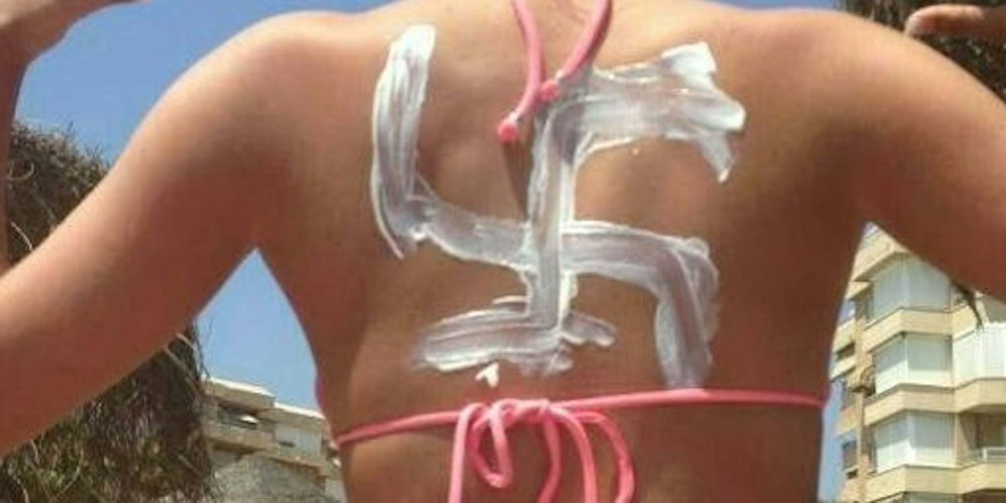 Thomas Dahm postete dieses Foto aus dem Sommerurlaub: Darauf zu sehen: eine Frau mit Hakenkreuz aus Sonnencreme auf dem Rücken. Er selbst findet die Aktion „lustig“, kündigte aber an, dieses Foto löschen zu wollen.
