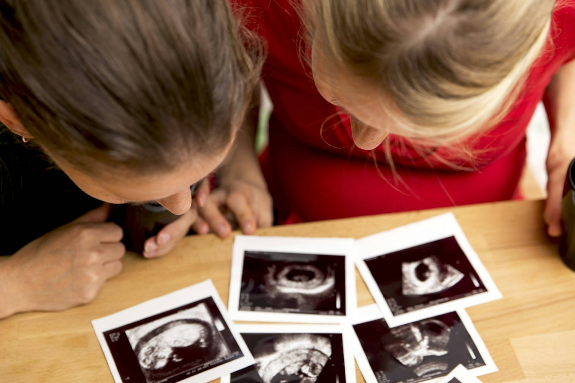 Ultraschall-Bilder lassen nur erahnen, wie rasant sich das Baby entwickelt.