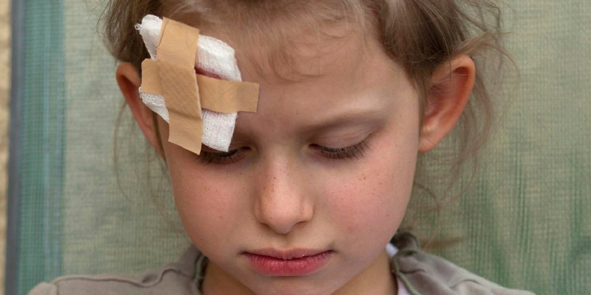 Selbst wenn alles in Ordnung scheint, Eltern sollten ihre Kinder nach einer Kopfverletzung beobachten.