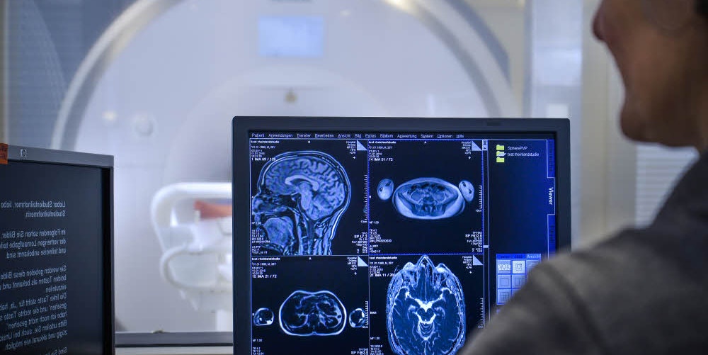 Gehirnuntersuchungen mit einem MRT spielen bei der Rheinland-Studie eine entscheidende Rolle.