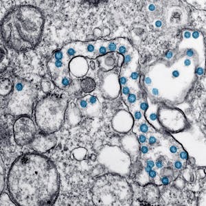 Coronavirus Mikroskop blau
